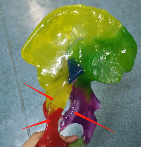 3D打印右侧髋臼彩色模型