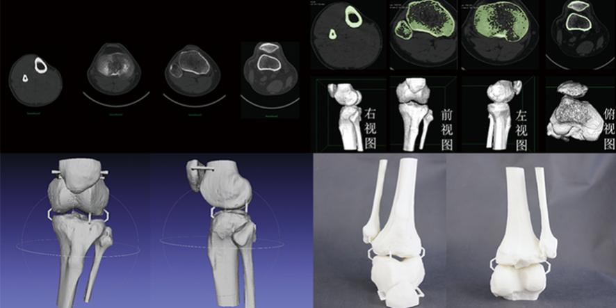 CTάؽģģ;ϸģ޸ģ3Dӡٳ