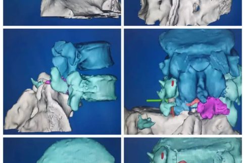 3DӡģԽֱۡ˽⻼ߵĲƶӦƻ߽Ƽƻ.webp