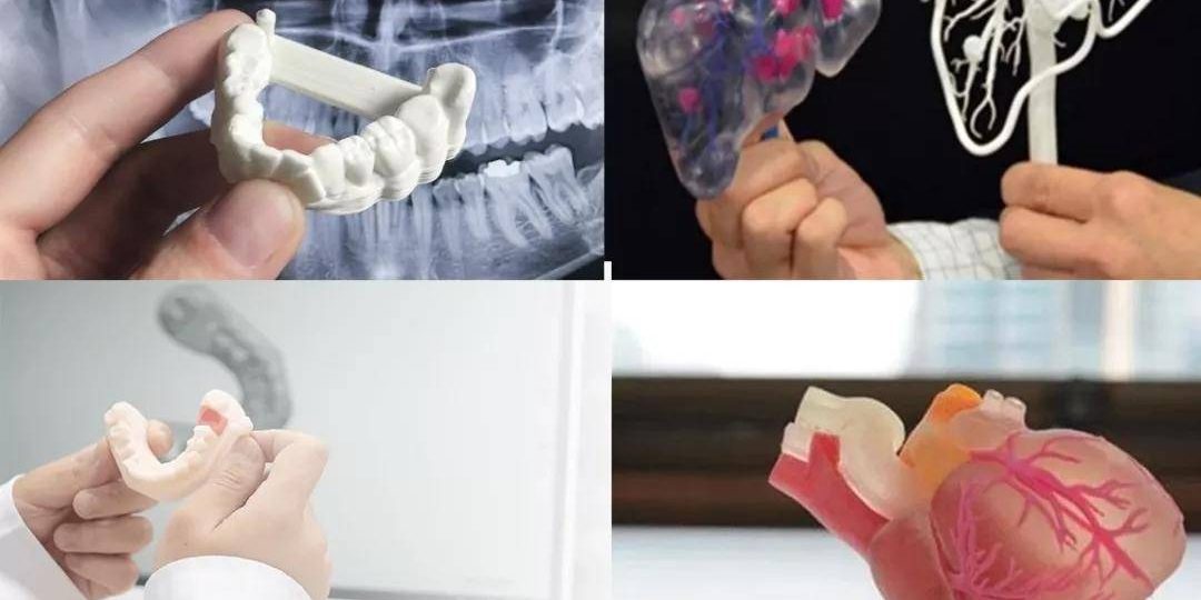 CTάؽҽѧ3DӡڹǿеľӦ