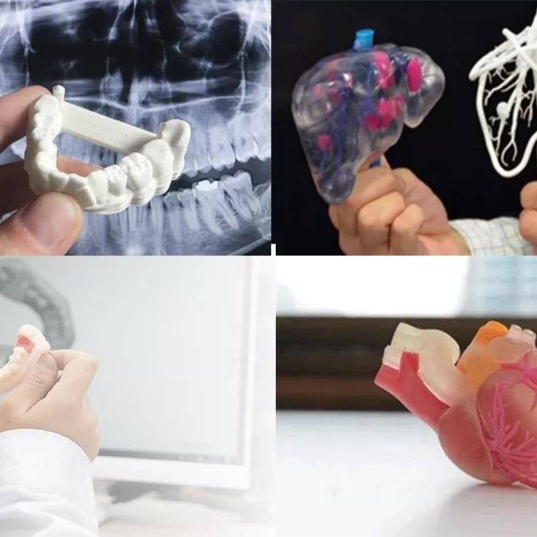 CTάؽҽѧ3DӡڹǿеľӦ