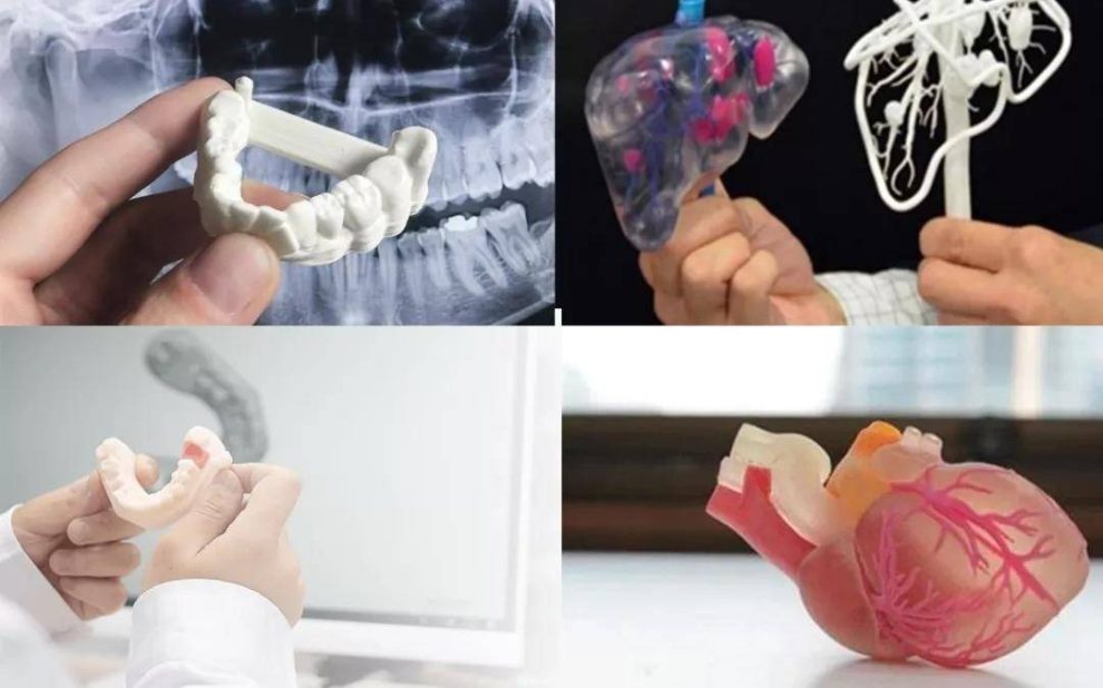 CTάؽҽѧ3DӡڹǿеľӦ